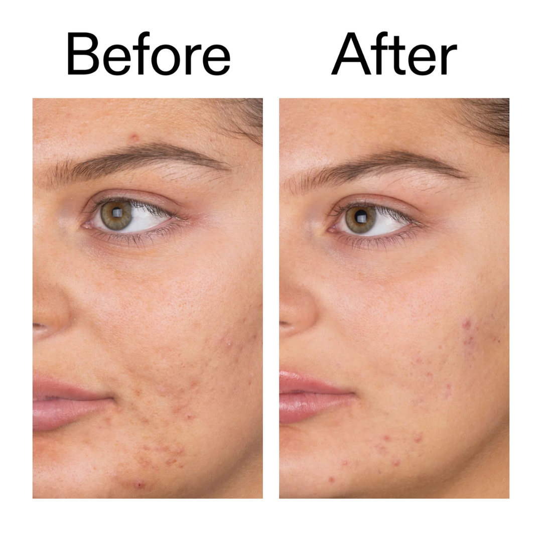 The INKEY List Salicylic Acid Foam Cleanser