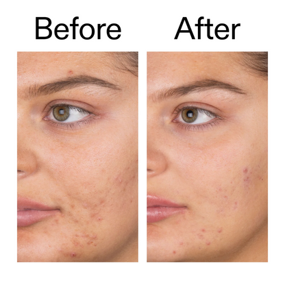 The INKEY List Salicylic Acid Foam Cleanser