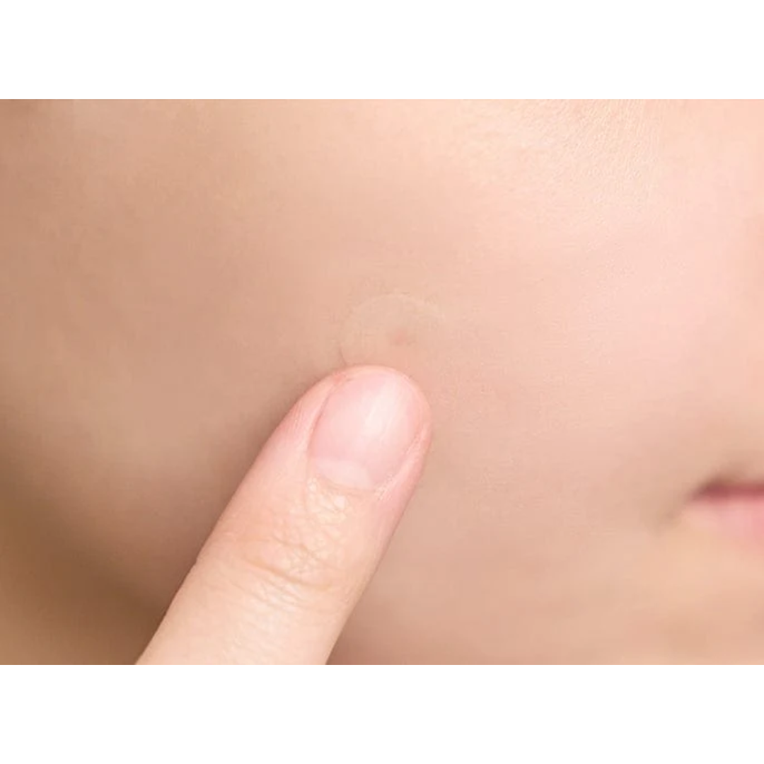 SKIN1004 Spot Cover Patch Ultra-thin Patches for Imperfections