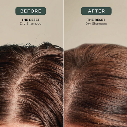 The Reset Dry Shampoo